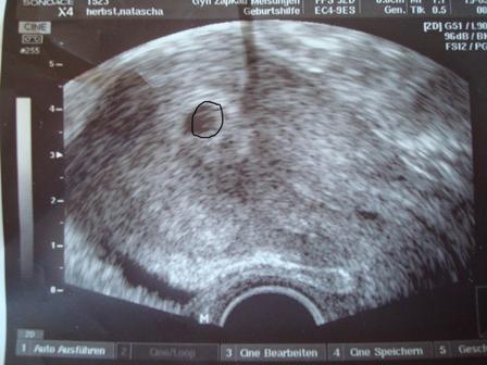 Bild zu Vorstellung:) - Forum für Januar - Mamis