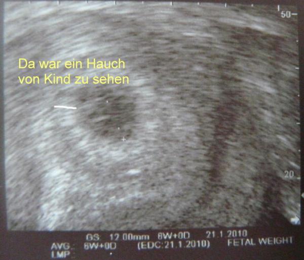 Bild zu War beim Doc - Forum für Januar - Mamis