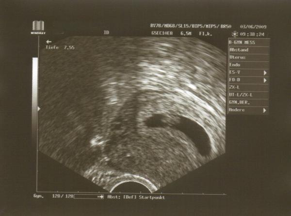 Bild zu Hatte heute ja FA Termin - Forum für Januar - Mamis
