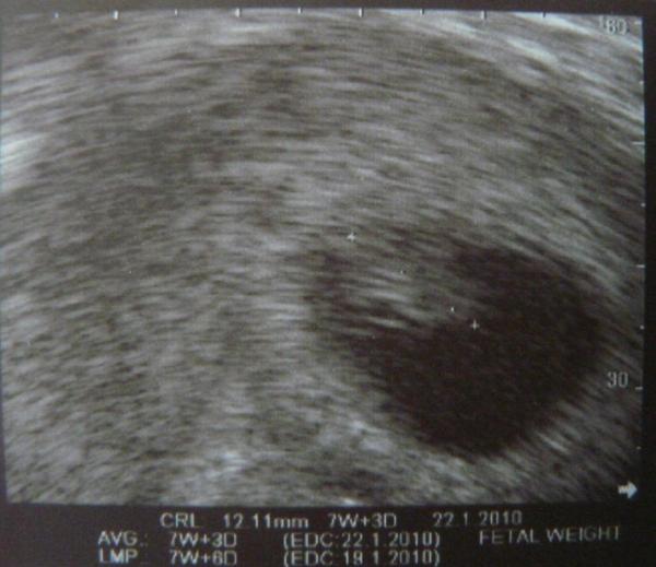 Bild zu Eckenhocker - Forum für Januar - Mamis
