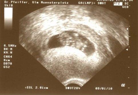 Bild zu hier noch ein Bild :) - Forum für Januar - Mamis