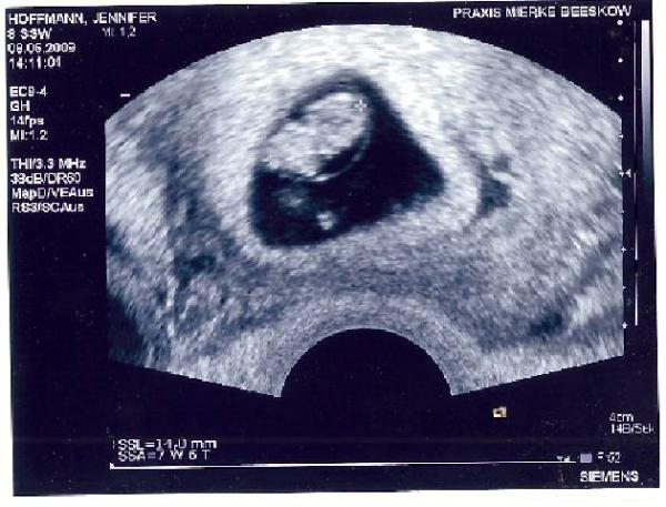 Bild zu mein erstes bildchen - Forum für Januar - Mamis