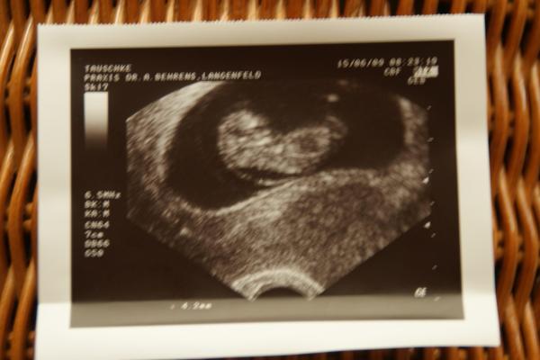 Bild zu Ultraschallbild vom kleinen Keks... - Forum für Januar - Mamis