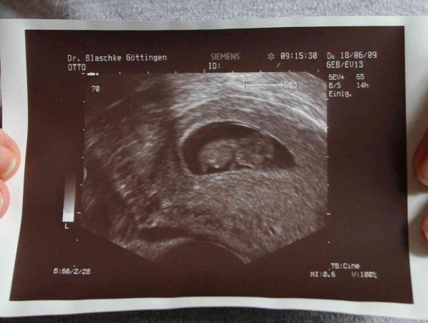 Bild zu Der erste Po-Wackler... - Forum für Januar - Mamis