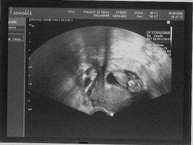 Bild zu *nachreich* mein bauchfloh-bild von gestern... - Forum für Januar - Mamis