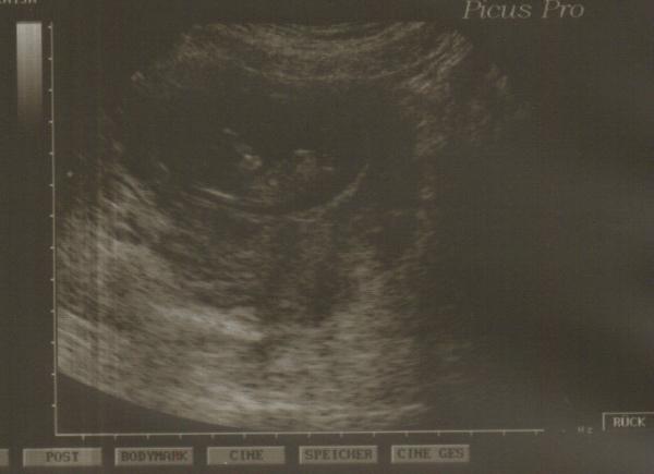 Bild zu FA-Termin und auch mal wieder hier - Forum für Januar - Mamis