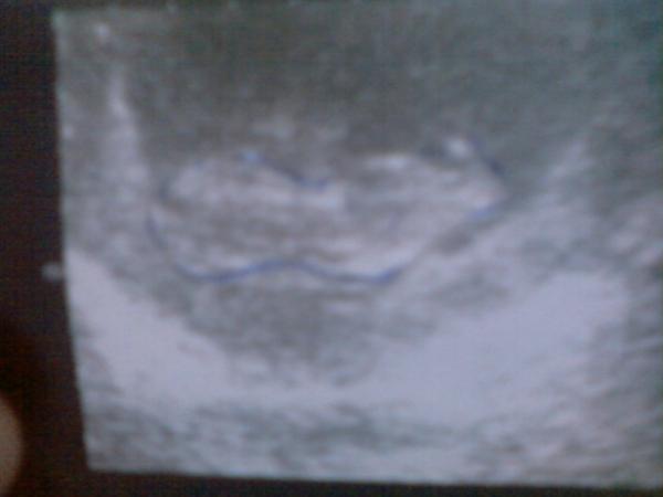 Bild zu ultraschal bild - Forum für Januar - Mamis