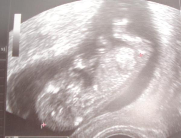 Bild zu FA besuch mit Bildchen :-) + auch verwirrt :-( - Forum für Januar - Mamis