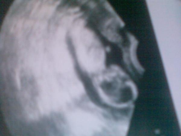 Bild zu ultraschal bild - Forum für Januar - Mamis
