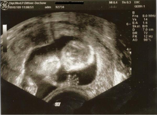 Bild zu Heute Termin + super schönes Bild - Forum für Januar - Mamis