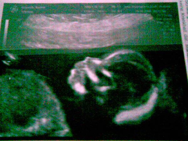 Bild zu zurück vom FA + bildchen - Forum für Januar - Mamis