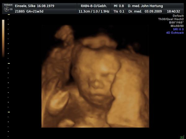 Bild zu 3D US & OUTING (o: - Forum für Januar - Mamis