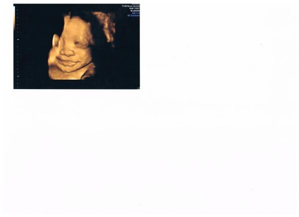 Bild zu 4 d Ultraschall - Forum für Januar - Mamis