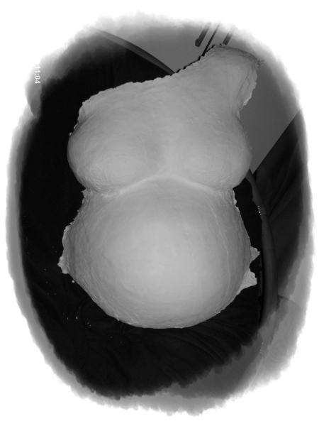 Bild zu Gipsbauch - Forum für Januar - Mamis