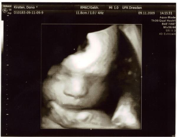 Bild zu neues bild - Forum für Januar - Mamis