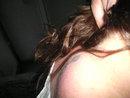 Bild zu hab mal n foto gemacht von meinem Nacken ! - Forum für Januar - Mamis
