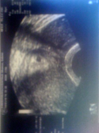 Bild zu Angst... - Forum für Januar - Mamis
