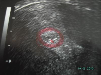 Bild zu Mein erstes US- Bildchen! - Forum für Januar - Mamis