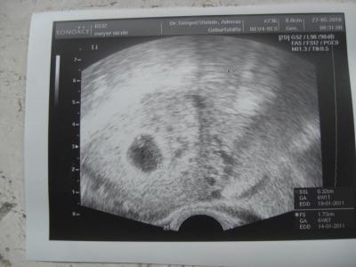 Bild zu Zurück vom FA und der glücklichste Mensch auf Erden! - Forum für Januar - Mamis