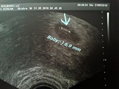 Bild zu Auch wieder zurück vom FA! - Forum für Januar - Mamis