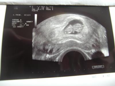Bild zu wie versprochen die Fotos :-) - Forum für Januar - Mamis