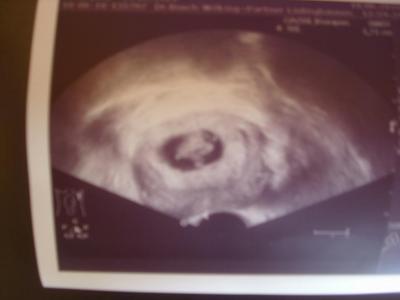 Bild zu Hier mein Bild von heute - Forum für Januar - Mamis