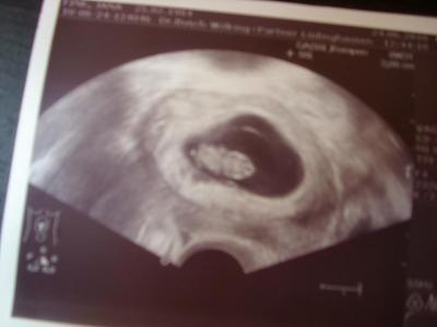 Bild zu Schaut euch das mal an... - Forum für Januar - Mamis