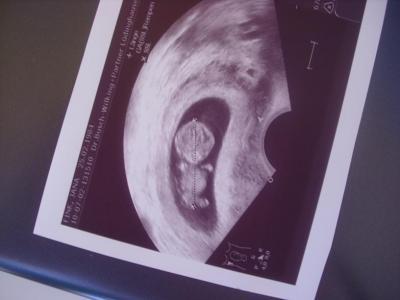 Bild zu Juhuuu, zurück vom Fa - Forum für Januar - Mamis