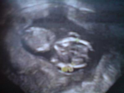 Bild zu Wieder zurück vom FA!!!!!! ;) - Forum für Januar - Mamis