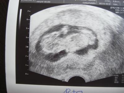 Bild zu Zurück vom FA und alles in Ordnung :-) - Forum für Januar - Mamis