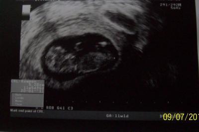 Bild zu US Bild von Dienstag von unserem Riesenzwerg :-) - Forum für Januar - Mamis