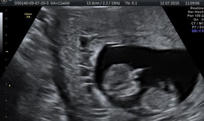 Bild zu Unser Murkelchen heute beim US - Forum für Januar - Mamis