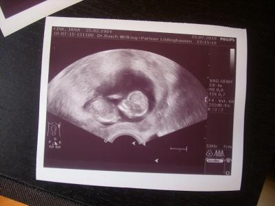 Bild zu Meine Us Bildchen von heute.. - Forum für Januar - Mamis