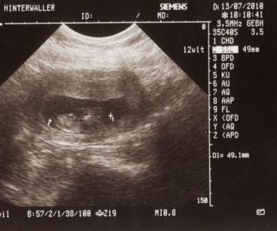 Bild zu US Bild - Forum für Januar - Mamis