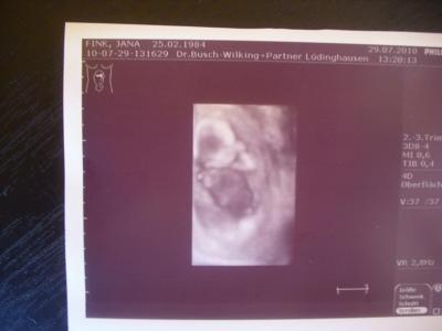 Bild zu Zurück vom fa und 3 D Us !! - Forum für Januar - Mamis