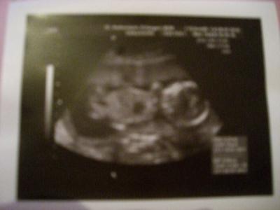 Bild zu Bericht vom FA - Forum für Januar - Mamis