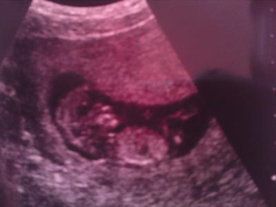 Bild zu So hier mal das letzte US Bild - Forum für Januar - Mamis