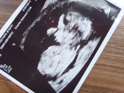 Bild zu Und hier meine kleine Schnute... - Forum für Januar - Mamis