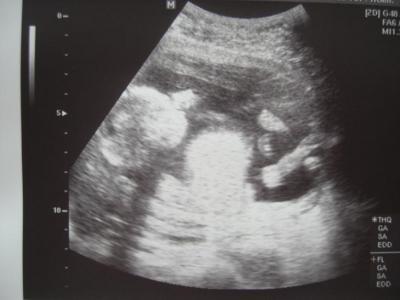 Bild zu Zurück von VU mit Outing - Forum für Januar - Mamis