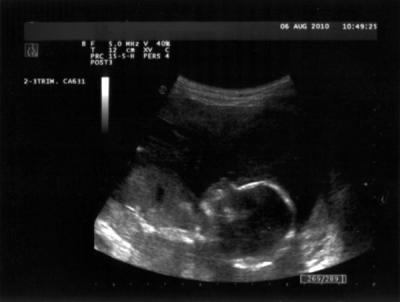 Bild zu Das Mäuschen... - Forum für Januar - Mamis