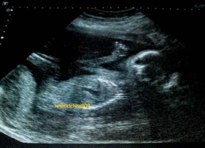 Bild zu Endlich Ultraschallbilder von der FD:) - Forum für Januar - Mamis