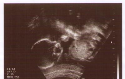 Bild zu Nun endlich die Us-Bilder von letzter Wo. mit Outingbild - Forum für Januar - Mamis