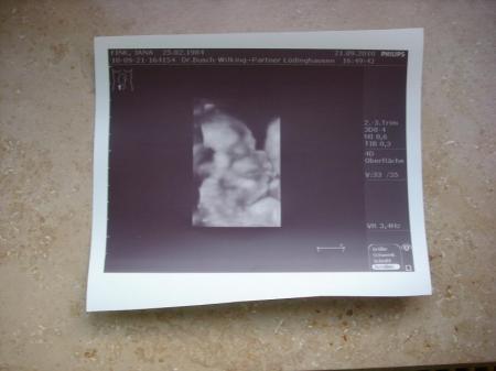 Bild zu 