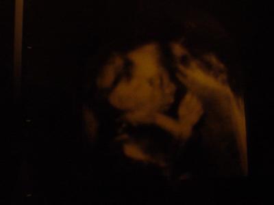 Bild zu Hier mal das Gesicht:-) - Forum für Januar - Mamis