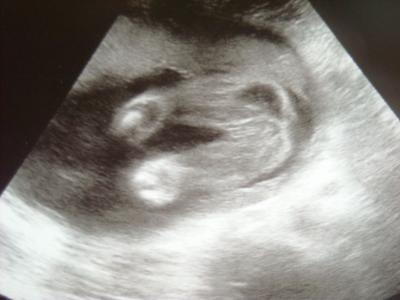 Bild zu Bericht vom FA!!! - Forum für Januar - Mamis
