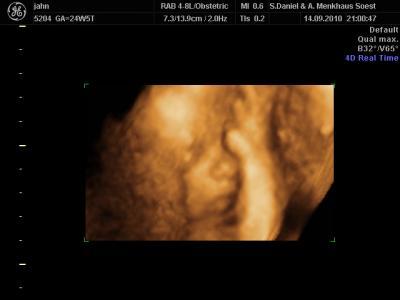Bild zu 3 D Fotos unserer Prinzessin - Forum für Januar - Mamis