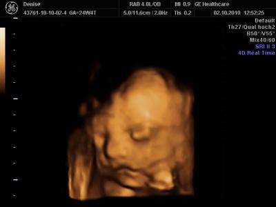 Bild zu Zurück vom 3 D Ultraschall! - Forum für Januar - Mamis