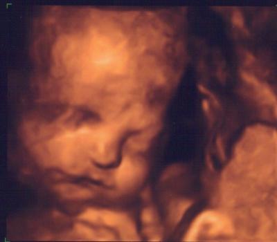 Bild zu 3D-Ultraschall Bild - Forum für Januar - Mamis