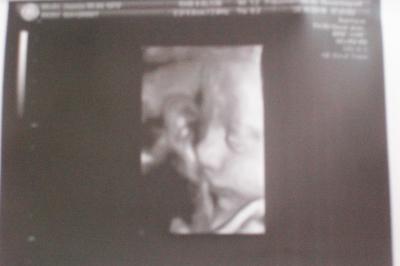 Bild zu 3D Bilder - Forum für Januar - Mamis