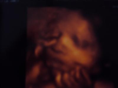 Bild zu Das Baby in der 32.ssw - Forum für Januar - Mamis